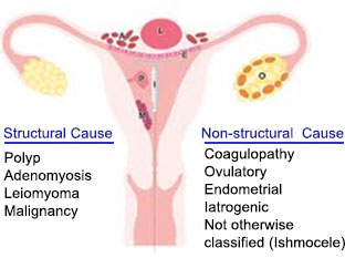Abnormal Uterine Bleeding